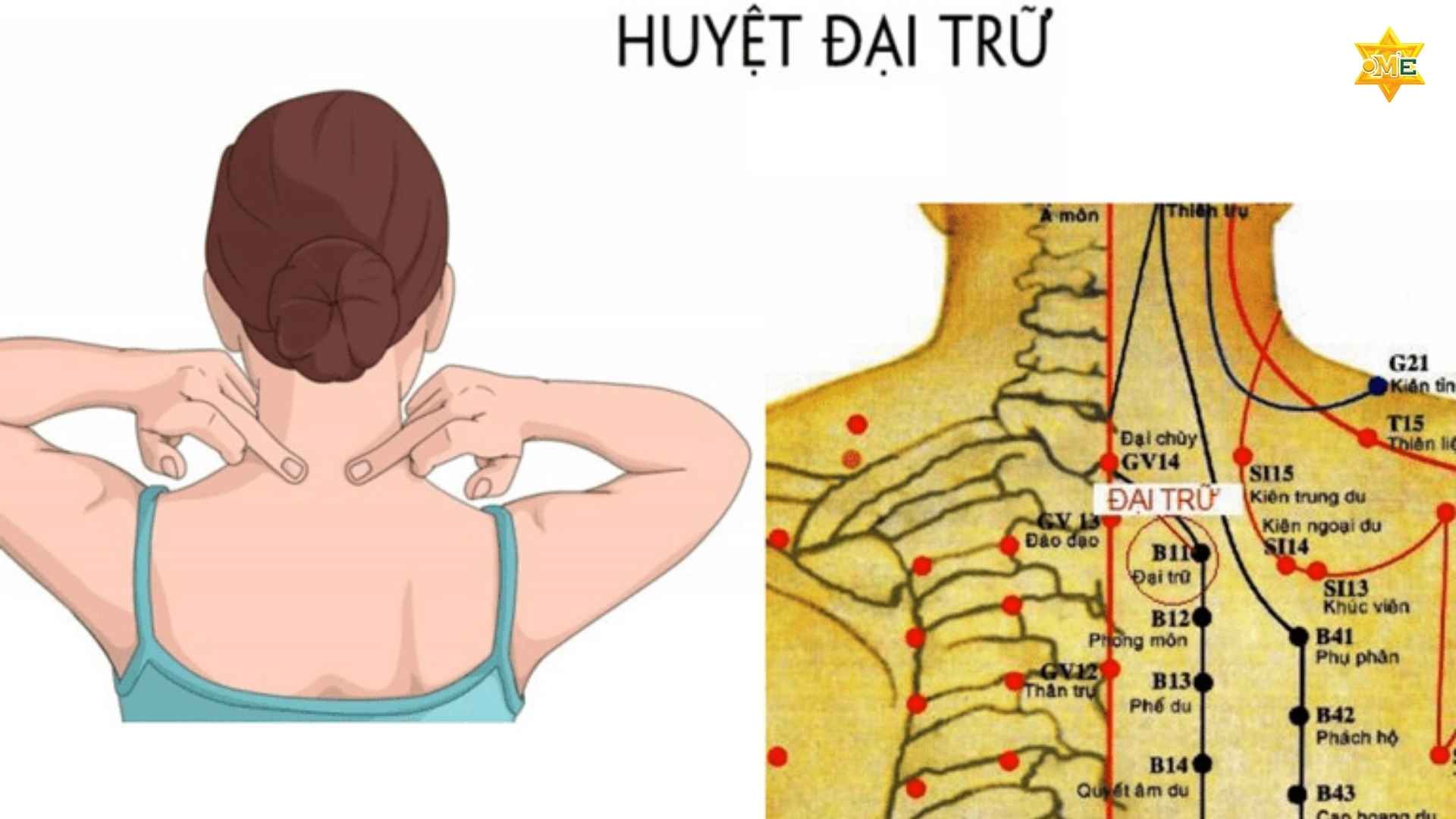 Cách xác định huyệt trên lưng để giảm đau mỏi hiệu quả tại nhà