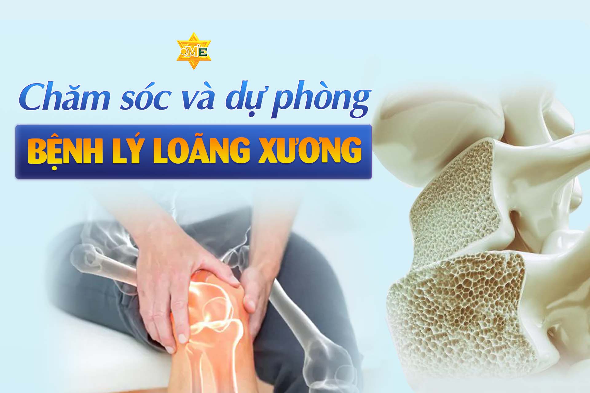 Chăm sóc và dự phòng bệnh lý loãng xương
